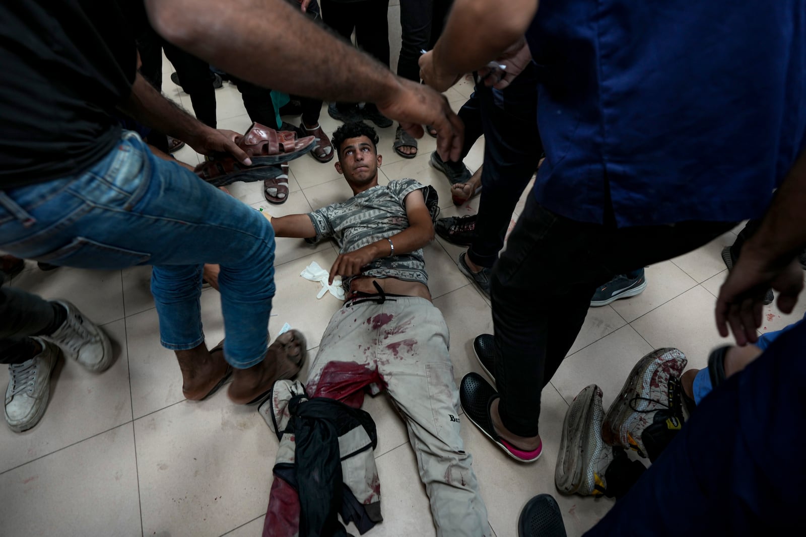 A Palestinian wounded in the Israeli bombardment of the Gaza Strip is treated in a hospital in Deir al Balah, Saturday, Oct. 19, 2024. (AP Photo/Abdel Kareem Hana)