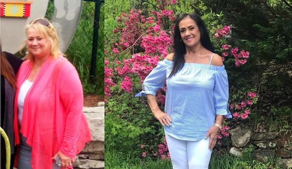 Karen Uyttenhove make changes in her lifestyle in response to medical issues. The photo on the left was taken in 2017. The photo on the right was taken in 2020. (Photos contributed by Karen Uyttenhove)