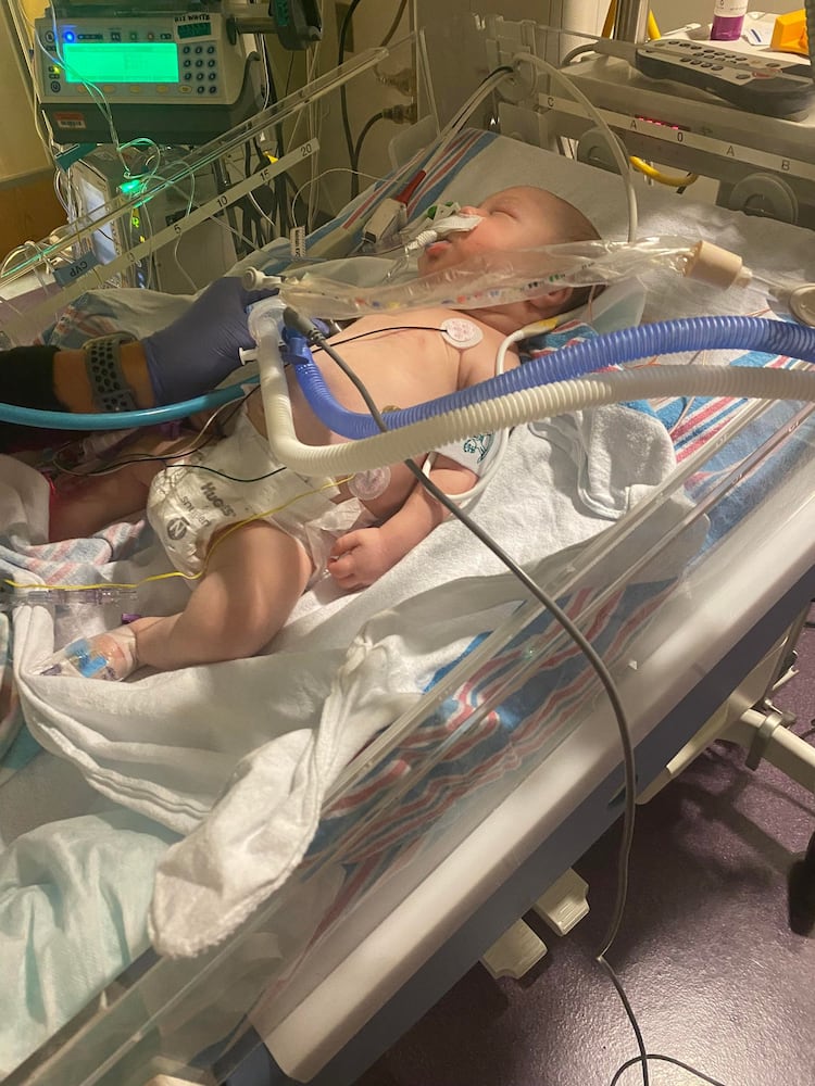 Canton baby survives severe RSV