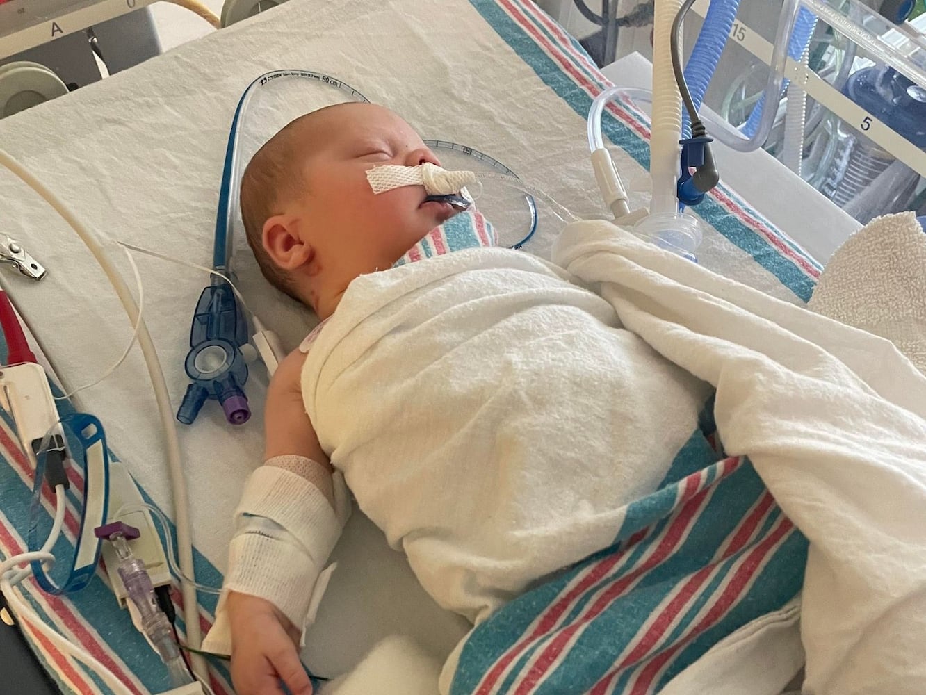 CHOA hospital treats Canton baby for severe RSV