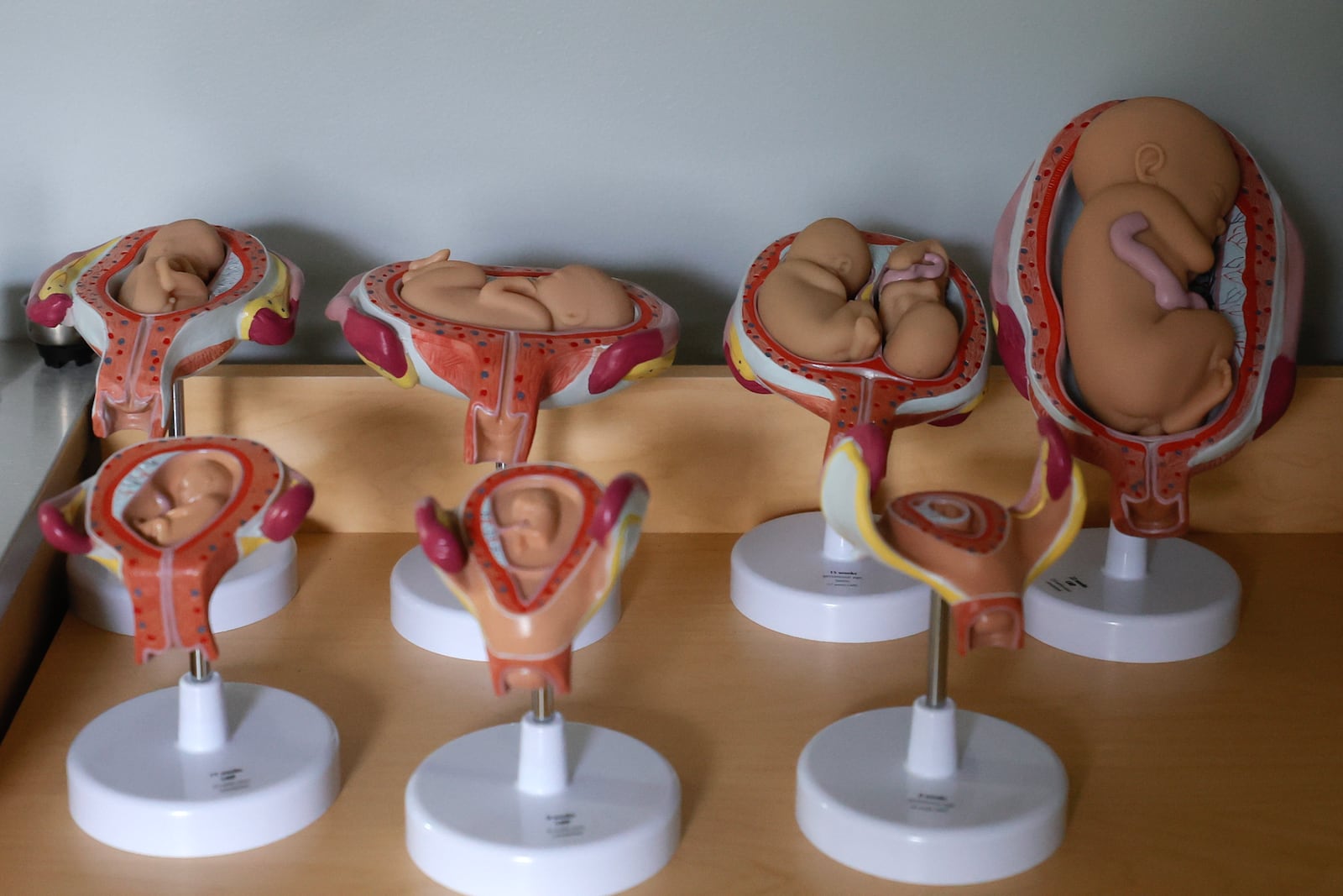 A fetus model sits on a table in an examination room at Atlanta Morning Center in Dunwoody. (Natrice Miller/natrice.com@ajc.com)