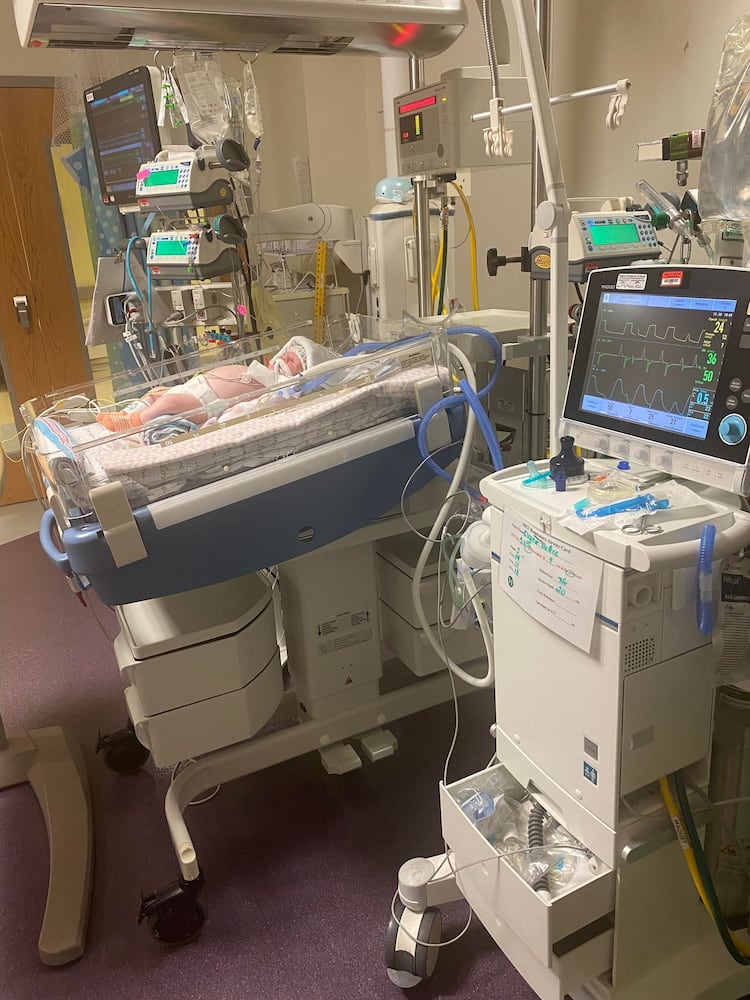 Canton baby survives severe RSV