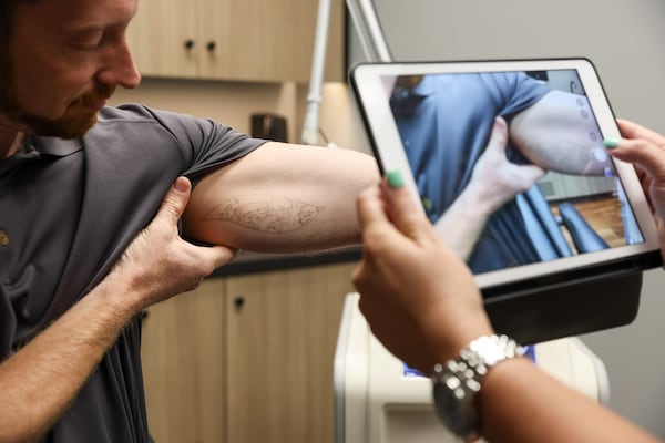 Rob Eskew shows one of his tattoos during his removal appointment at Removery in Sandy Springs. (Arvin Temkar / arvin.temkar@ajc.com)