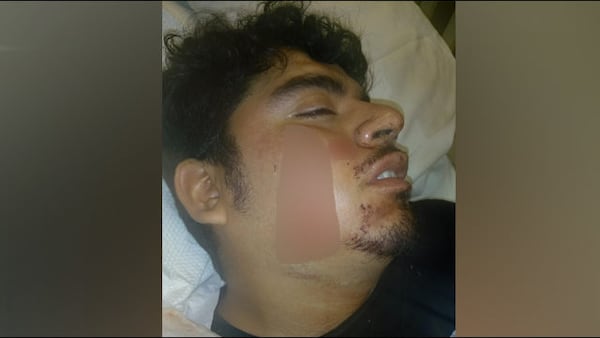 A 26-year-old Marietta man is recovering after he was stabbed in the face outside a Kennesaw bar. He required 25 stitches, according to Channel 2 Action News. (Credit: Channel 2 Action News) 