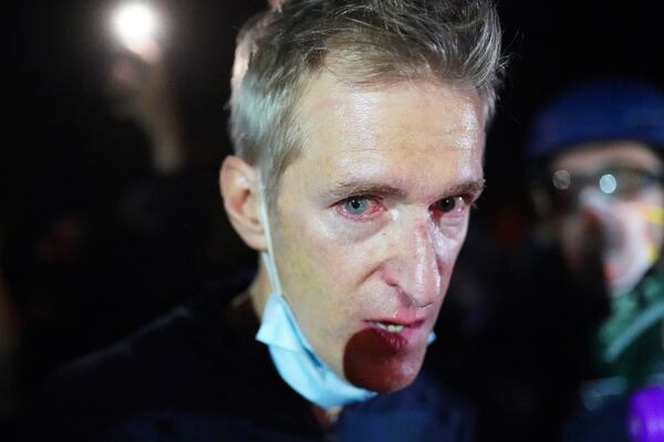 Portland Mayor Ted Wheeler reacts after being exposed to tear gas fired by federal officers while attending a protest against police brutality and racial injustice in front of the Mark O. Hatfield U.S. Courthouse on July 22 in Portland, Oregon. (Nathan Howard/TNS)