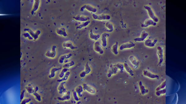 A wet mount of Naegleria fowleri. (Photo: CDC)