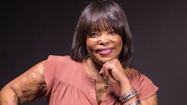 06/13/2018 -- Dunwoody, GA -- Christy Sims poses for a portrait in the studio at the Atlanta Journal-Constitution office building in Dunwoody, Wednesday, June 13, 2018. 5 years ago, Christy Sims was living her best life. Working, mother of two, in a relationship. Then her boyfriend threw a bowl of acid in her face, forever changing her life. ALYSSA POINTER/ATLANTA JOURNAL-CONSTITUTION