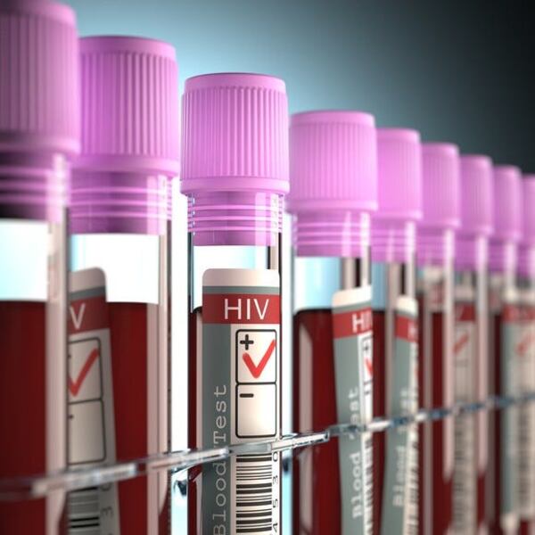 HIV-positive sample vials