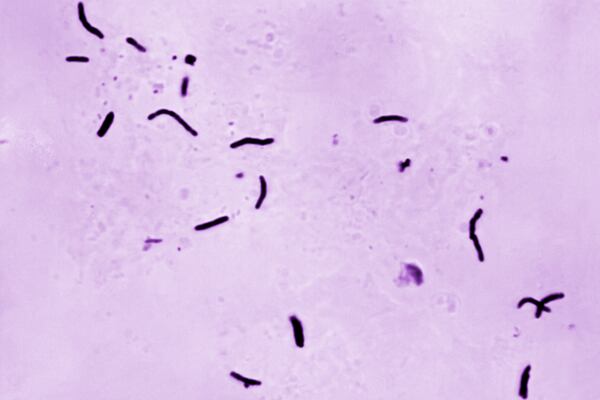 This 1966 microscope photo provided by the U.S. Centers for Disease Control and Prevention shows Mycobacterium tuberculosis bacilli, the organism responsible for causing the disease tuberculosis. (Elizabeth S. Mingioli/CDC via AP)