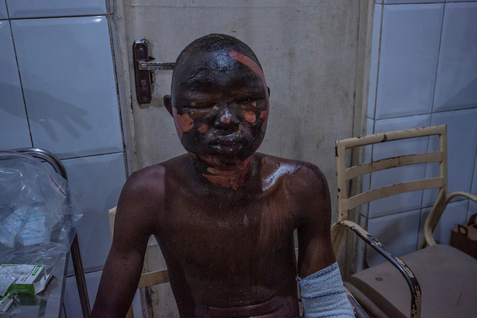 EDS NOTE: GRAPHIC CONTENT - A victim of a tanker explosion from Majiya town receive treatment at the Aminu Kano teaching hospital in Kano Nigeria, Wednesday, Oct. 16, 2024. (AP Photo/Sani Maikatanga)