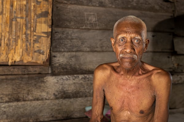 Ilyas, 70, who has been complaining of itchy skin rashes, sits for a photograph at his house on Kabaena Island near nickel mining activities in South Sulawesi, Indonesia, Friday, Nov. 15, 2024. (AP Photo/Yusuf Wahil)