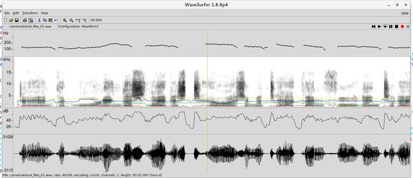 This graph shows the tonal frequencies produced by Jamie Dupree’s voice pronouncing a few words. The sounds were harvested from an audiotape of a radio broadcast by Dupree. The statistical analysis of his voice was completed by Scotland-based company CereProc, which used that information to create a synthetic voice for Dupree. CONTRIBUTED BY CEREPROC