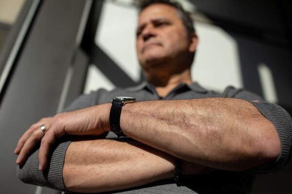 Georgia State University Professor Dr. Volkan Topalli shows a scar on his left arm during a portrait that resulted from a gunshot wound while shopping at a Home Depot earlier this year, Wednesday, Dec. 22, 2021, in Atlanta. (BRANDEN CAMP FOR THE ATLANTA JOURNAL-CONSTITUTION)