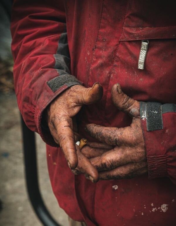 The dirty hands of a homeless man in Atlanta. CONTRIBUTED