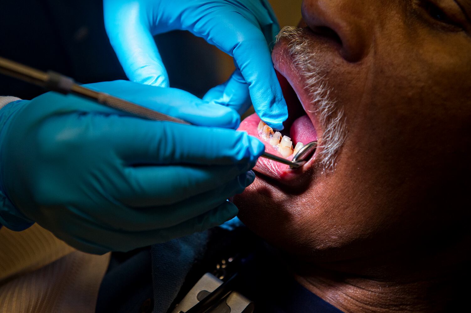 Mercifully providing free dental care in Atlanta