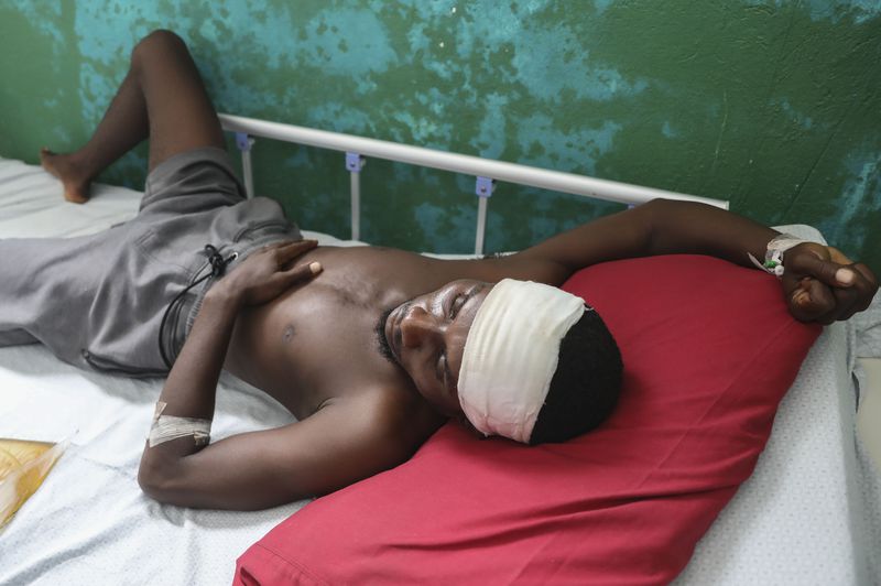 Germain Rivaldo, wounded by a bullet during armed gang attacks, lies on a bed at Saint Nicolas hospital in Saint-Marc, Haiti, Sunday, Oct. 6, 2024. (AP Photo/Odelyn Joseph)