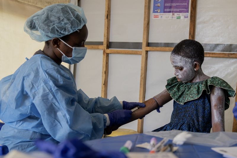 A health worker attends to Lucie Habimana, 13, a mpox patient, at a treatment centre in Munigi, eastern Congo, Friday, Aug. 16, 2024. (AP Photo/Moses Sawasawa)