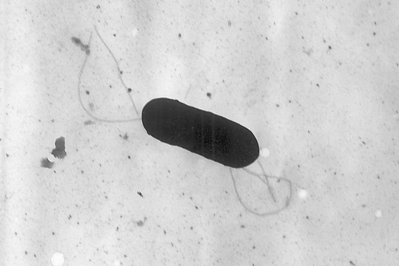 FILE - This 2002 electron microscope image made available by the Centers for Disease Control and Prevention shows a Listeria monocytogenes bacterium. (Elizabeth White/CDC via AP, File)