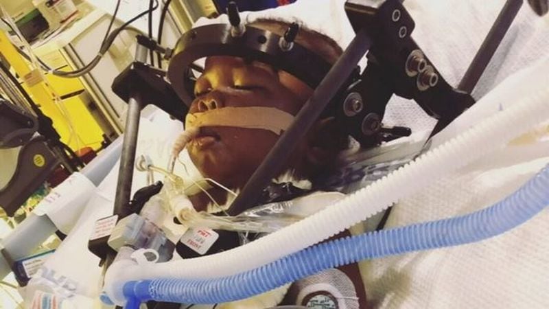 Nolan Bennett, 7 months, has had multiple surgeries since the May 18 crash in southwest Atlanta.